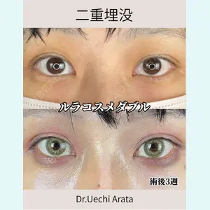 症例