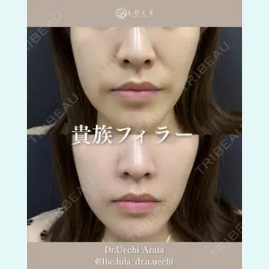 症例