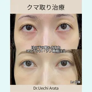 症例