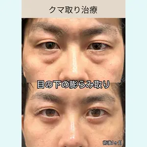 症例