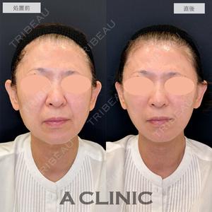 症例