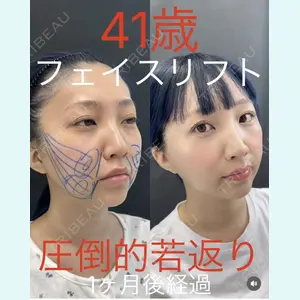 症例
