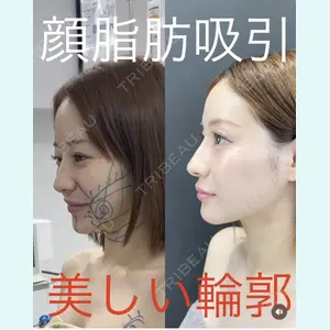 症例