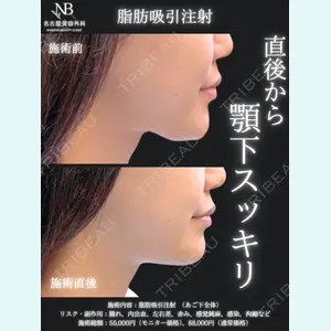 症例