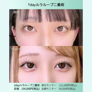 症例