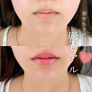 症例