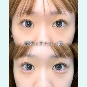 症例