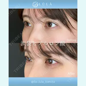 症例