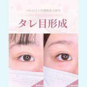 症例