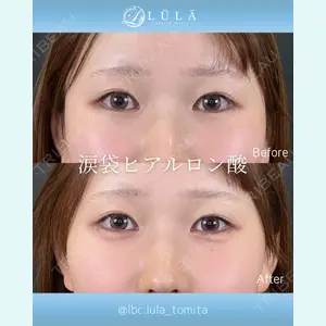 症例