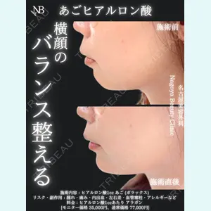 症例