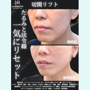 症例