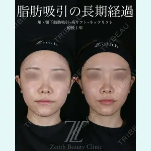 症例
