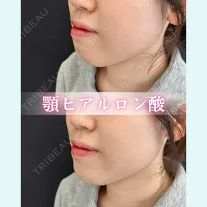 症例