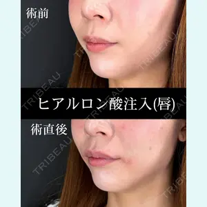 症例