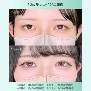 症例