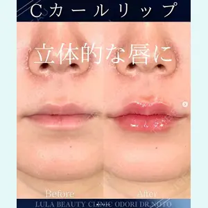 症例