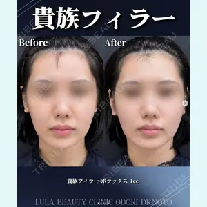症例