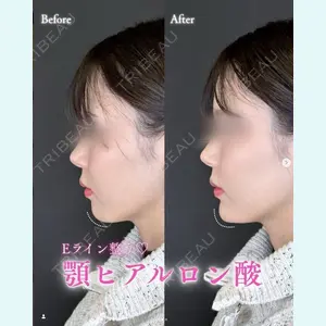 症例