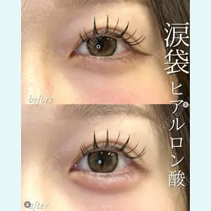 症例