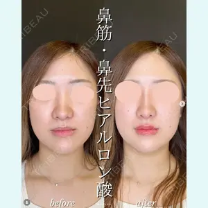 症例