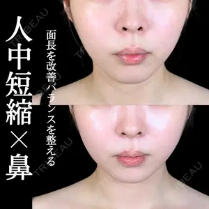 症例