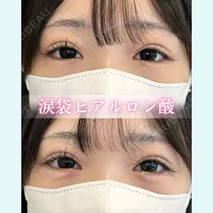 症例
