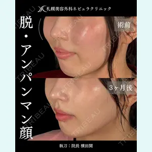 症例