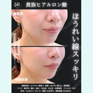 症例