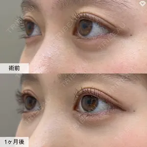 症例