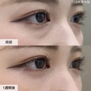 症例