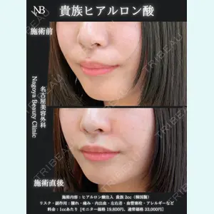 症例