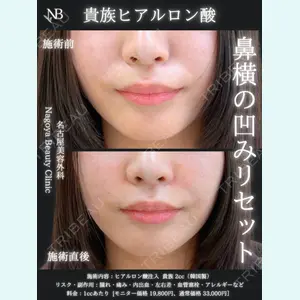 症例