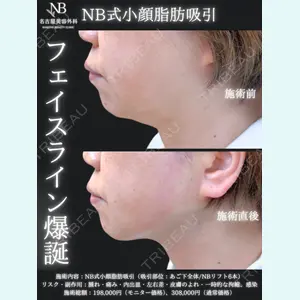 症例