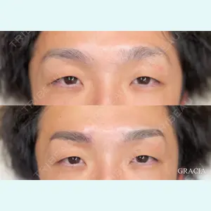 症例