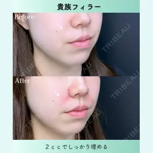 症例