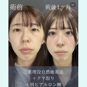 症例