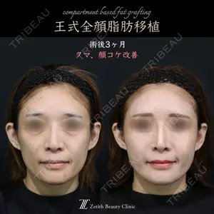 症例