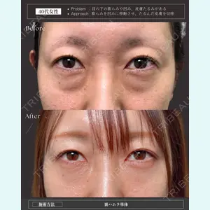 症例