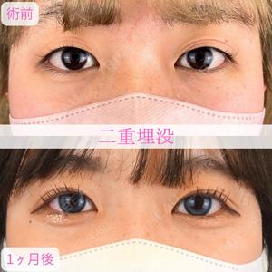 岩本 桂医師の症例
