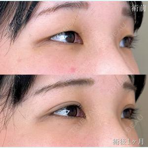 岩本 桂医師の症例