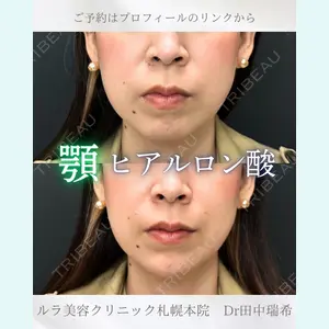 症例