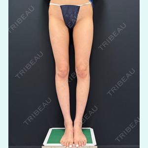 症例
