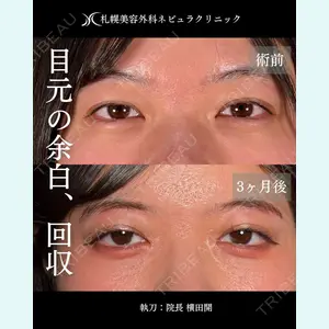症例