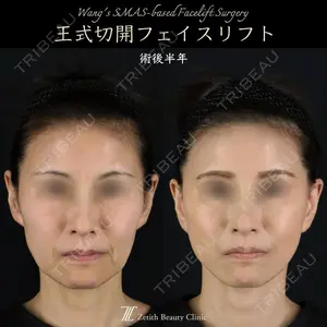 症例