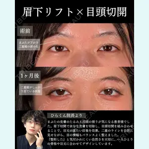 症例
