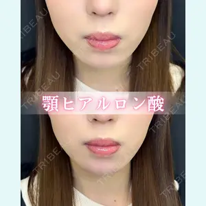 症例