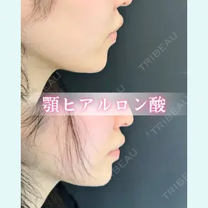 症例