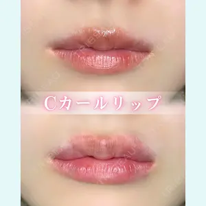 症例