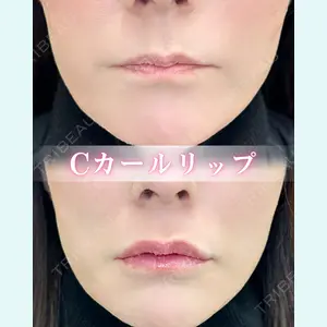 症例